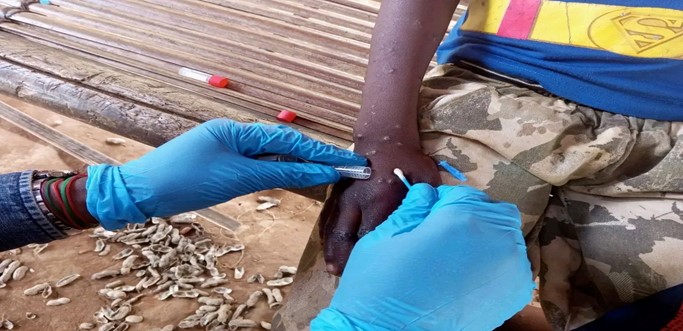 First Mpox related death reported in Yambio as hospitals struggle to contain virus